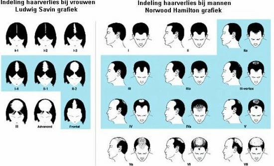 HairMax Laserband 82 - Afbeelding 13