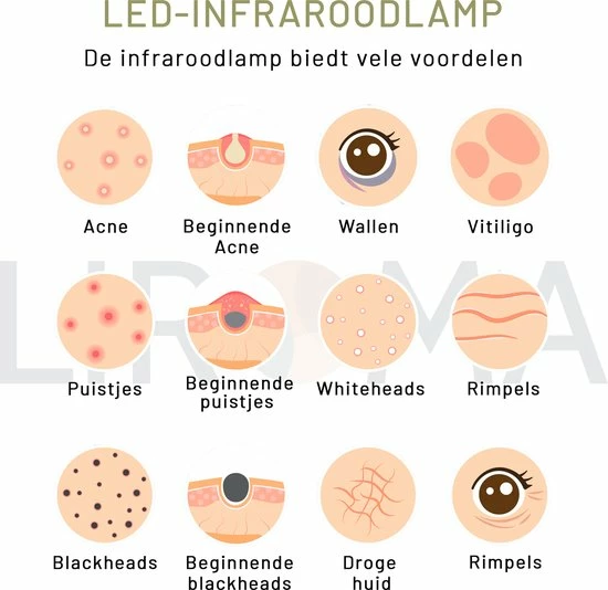 LIROMA? - LED Infraroodlamp - Hoogte Verstelbaar - 2 Golflengten - Rood Licht Therapie - Collageen Lamp ? Bevordert Bloedcirculatie ? Fibromyalgie - Warmtelamp - Lichttherapie - Black Friday 2022 Deals - Afbeelding 4