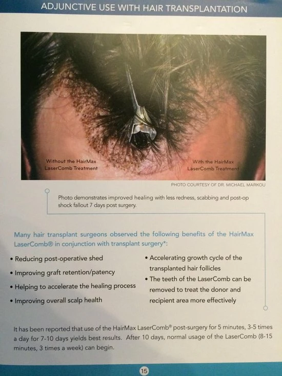 HairMax Laserband 82 - Afbeelding 5